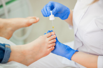 10 Tips for Expertly Treating Ingrown Toenail